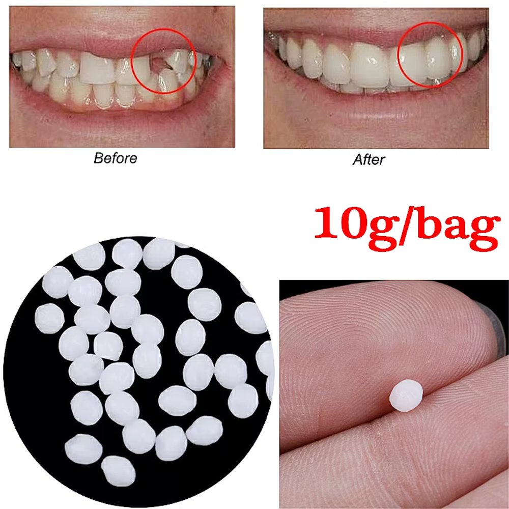 10g/Bag Tooth Repair Kit-Thermal Beads for Filling Fix The Missing and Broken Tooth or Adhesive The Denture Fake Teeth