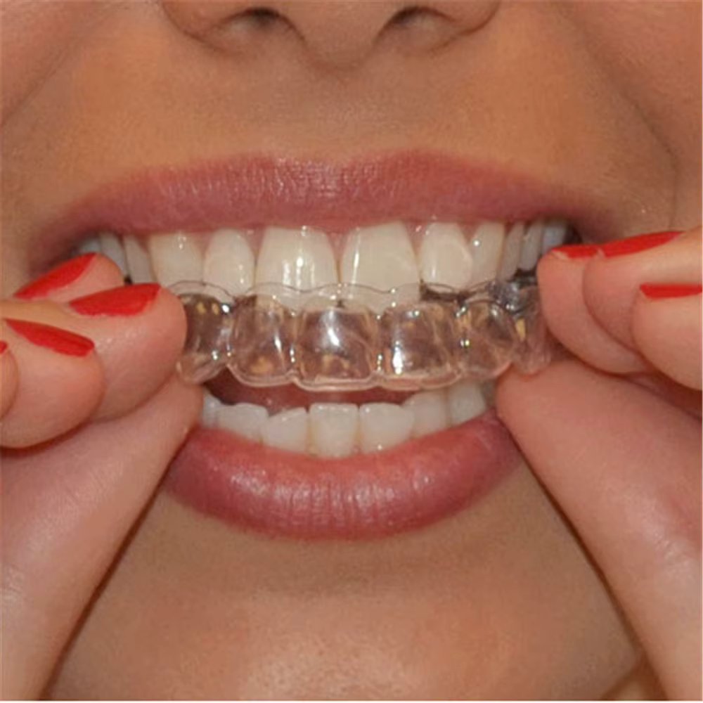 2 Pcs Moldable Mouth Dental Teeth Whitening Bleaching Molding Trays For Teeth WhitenOral Care Gel Mouthguard Tray Dropship