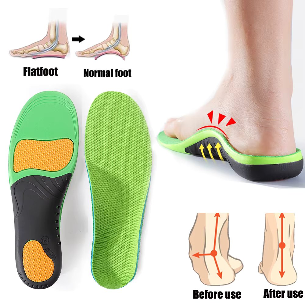 Orthopedic Insoles Sport Arch Support Flat Foot Orthotic Insoles for Shoes Women Men Arch Foot Pad X/O Leg Correction Shoe Pads