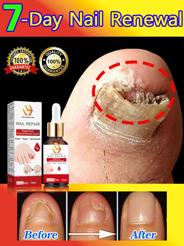 Highly effective repair of Foot nails