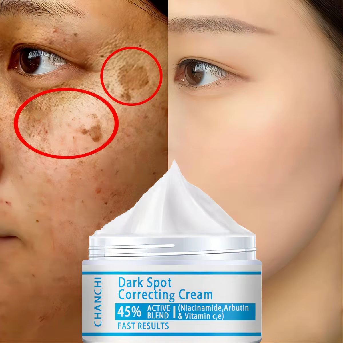 Whitening Freckles Cream Remove Melasma Dark Spot Lightening Melanin Brightening Melasma Remover Moisturize Anti-aging Face Care