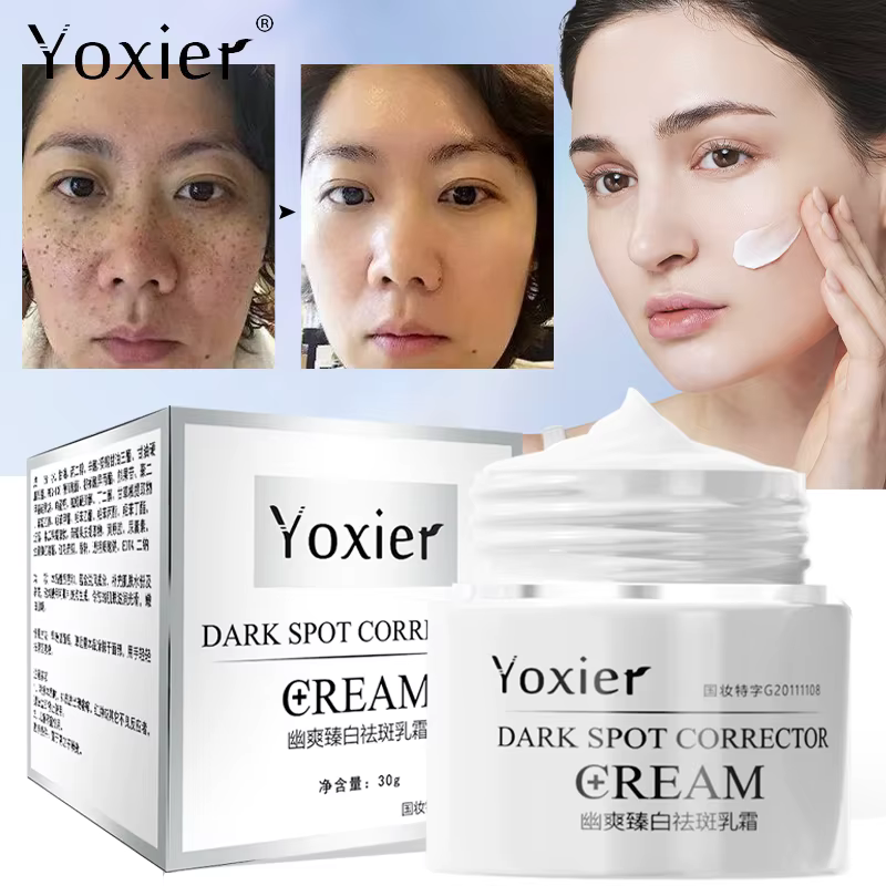 Effective Whiten Freckle Cream Remove Dark Spot Melasma Fade Melanin Anti-Pigmentation Improve Dullness Brighten Face Skin Care