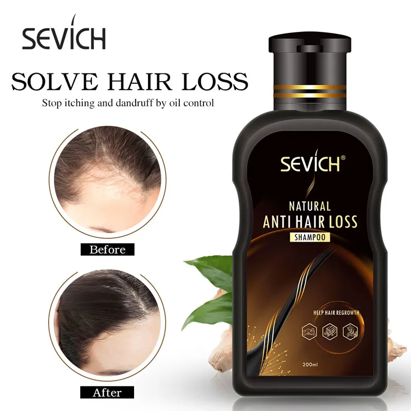 hair loss shampoo