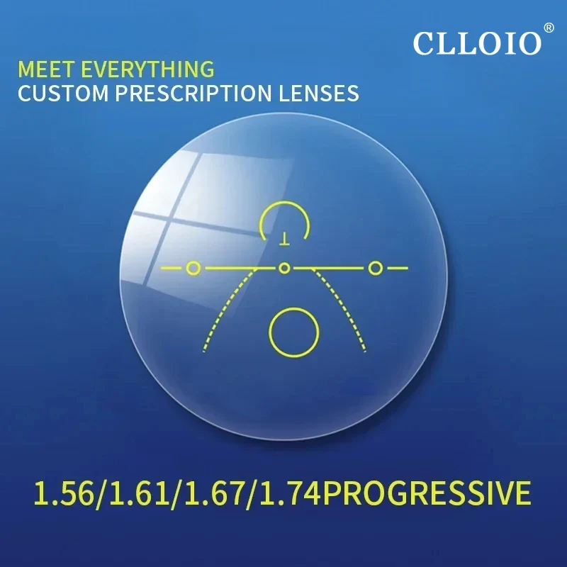 Progressive